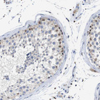 Anti-TCEAL9 Antibody