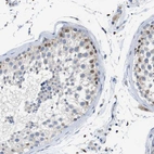 Anti-TCEAL9 Antibody