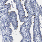 Immunohistochemical staining of human fallopian tube shows strong positivity in cilia in glandular cells.