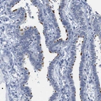 Immunohistochemical staining of human fallopian tube shows strong positivity in cilia in glandular cells.