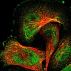 Immunofluorescent staining of human cell line U-251 MG shows localization to nucleoplasm & cytosol.