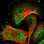 Immunofluorescent staining of human cell line U-251 MG shows localization to nucleoplasm & cytosol.