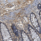 Anti-COL1A1 Antibody