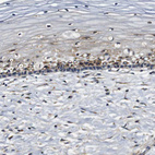 Immunohistochemical staining of human cervix shows moderate cytoplasmic positivity in squamous epithelial cells.