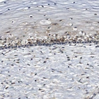 Immunohistochemical staining of human cervix shows moderate cytoplasmic positivity in squamous epithelial cells.