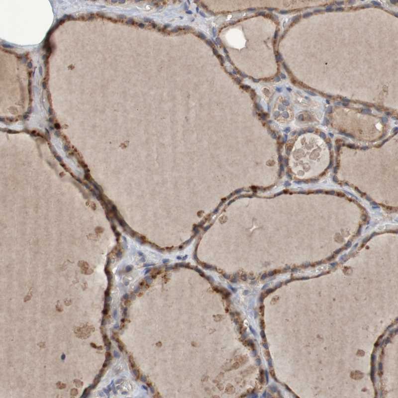 Anti-PHYH Antibody