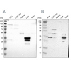 Western blot analysis using Anti-PHYH antibody HPA011796 (A) shows similar pattern to independent antibody HPA007598 (B).