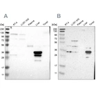 Western blot analysis using Anti-PHYH antibody HPA011796 (A) shows similar pattern to independent antibody HPA007598 (B).