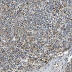 Anti-KAZALD1 Antibody