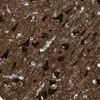 Immunohistochemical staining of human cerebral cortex shows very strong cytoplasmic positivity in neurons.