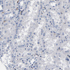 Immunohistochemical staining of human kidney shows no positivity in cells in tubules as expected.