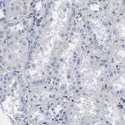 Immunohistochemical staining of human kidney shows no positivity in cells in tubules as expected.