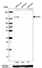 Western blot analysis in U-87MG ATCC cells transfected with control siRNA, target specific siRNA probe #1 and #2, using Anti-LRIG1 antibody. Remaining relative intensity is presented. Loading control: Anti-GAPDH.
