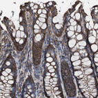 Immunohistochemical staining of human colon shows moderate cytoplasmic positivity in glandular cells.