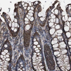 Immunohistochemical staining of human colon shows moderate cytoplasmic positivity in glandular cells.