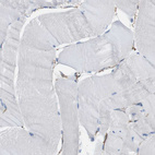 Immunohistochemical staining of human skeletal muscle shows no positivity in myocytes as expected.