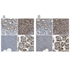 Immunohistochemical staining of human kidney, liver, pancreas and small intestine using Anti-ACBD5 antibody HPA011861 (A) shows similar protein distribution across tissues to independent antibody HPA012145 (B).