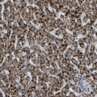 Immunohistochemical staining of human liver shows strong granular cytoplasmic positivity in hepatocytes.