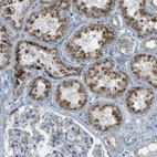 Immunohistochemical staining of human kidney shows moderate granular cytoplasmic positivity in cells in tubules.