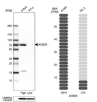 Western blot analysis in human cell lines A-549 and PC-3 using Anti-ACBD5 antibody. Corresponding ACBD5 RNA-seq data are presented for the same cell lines. Loading control: Anti-PPIB.