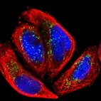 Immunofluorescent staining of human cell line A-431 shows localization to peroxisomes.