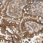 Anti-PCDH7 Antibody