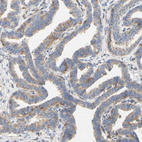 Anti-PCDH7 Antibody