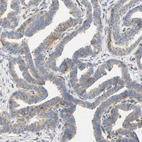 Immunohistochemical staining of human Fallopian tube shows weak to moderate membranous positivity in glandular cells.