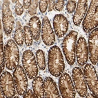 Immunohistochemical staining of human stomach shows strong membranous positivity in glandular cells.