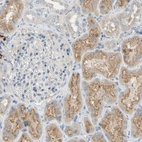 Immunohistochemical staining of human kidney shows moderate cytoplasmic positivity in cells in tubules.