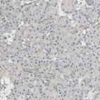 Anti-DKK3 Antibody