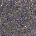 Immunohistochemical staining of human tonsil shows moderate membranous positivity in non-germinal center cells.