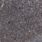 Immunohistochemical staining of human tonsil shows moderate membranous positivity in non-germinal center cells.