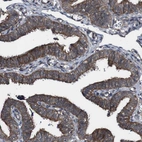 Immunohistochemical staining of human fallopian tube shows moderate membranous positivity in glandular cells.