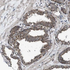 Immunohistochemical staining of human prostate shows moderate membranous positivity in glandular cells.