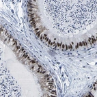 Immunohistochemical staining of human epididymis shows high expression.