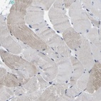 Anti-CUL4B Antibody