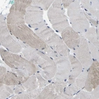 Immunohistochemical staining of human skeletal muscle shows low expression as expected.