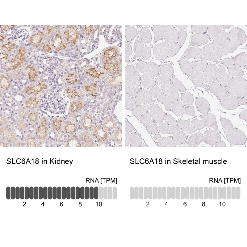 Anti-SLC6A18 Antibody