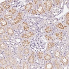 Anti-SLC6A18 Antibody