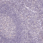 Anti-SLC6A18 Antibody