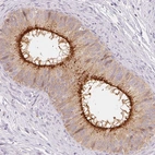 Immunohistochemical staining of human epididymis shows strong membranous positivity in glandular cells.