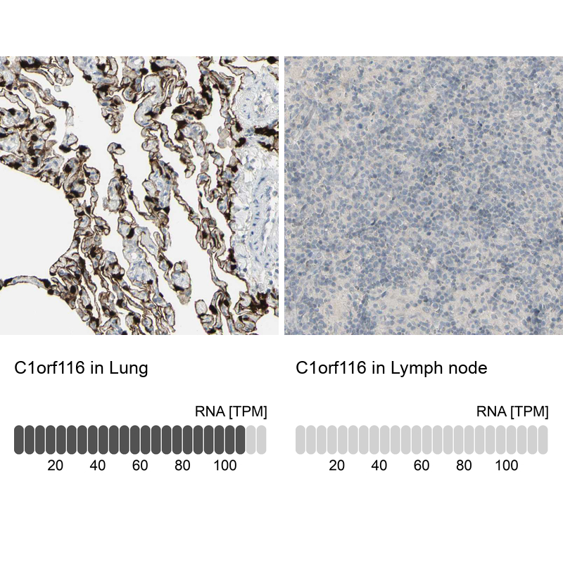 Anti-C1orf116 Antibody