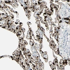 Immunohistochemical staining of human lung shows strong membranous positivity in pneumocytes.