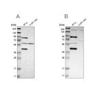Western blot analysis using Anti-C1orf116 antibody HPA011888 (A) shows similar pattern to independent antibody HPA011889 (B).