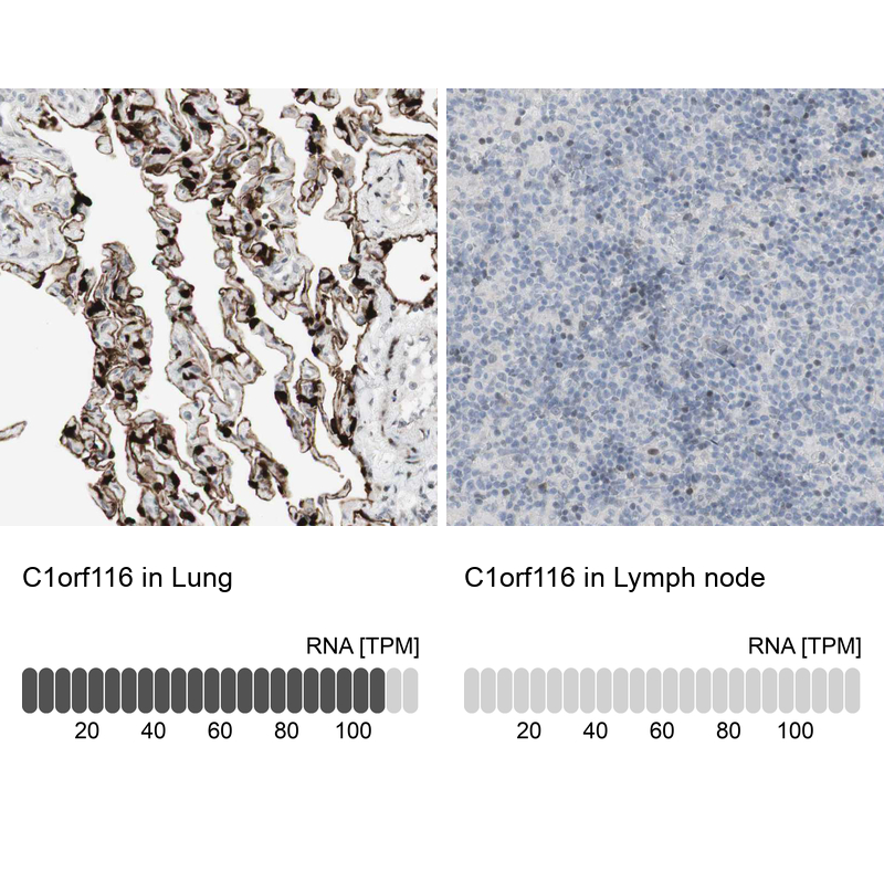 Anti-C1orf116 Antibody