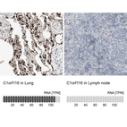 Anti-C1orf116 Antibody