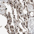 Immunohistochemical staining of human lung shows strong membranous positivity in pneumocytes.