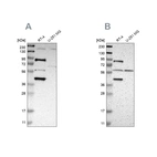 Western blot analysis using Anti-C1orf116 antibody HPA011889 (A) shows similar pattern to independent antibody HPA011888 (B).
