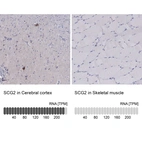 Anti-SCG2 Antibody